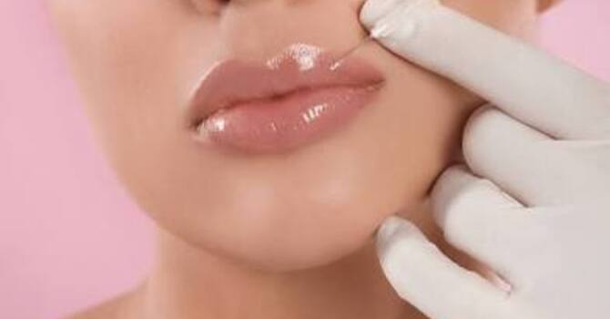 Dermal Fillers